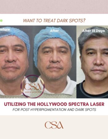 CSA Medical Aesthetics 