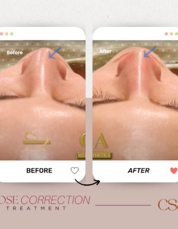 CSA Medical Aesthetics 