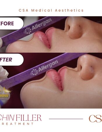 CSA Medical Aesthetics 
