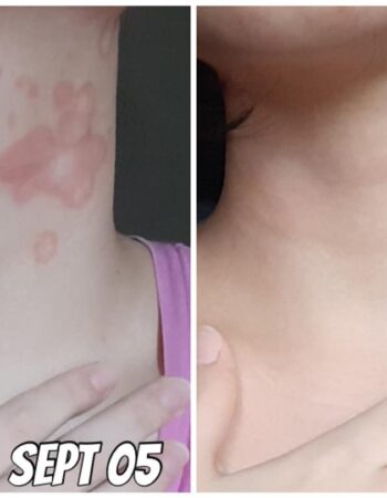 Maniulit Skin Disease and Medical Clinic