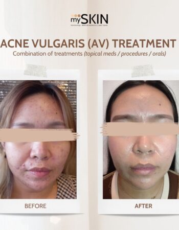 MySkin Dermatology Clinic and Aesthetic Center